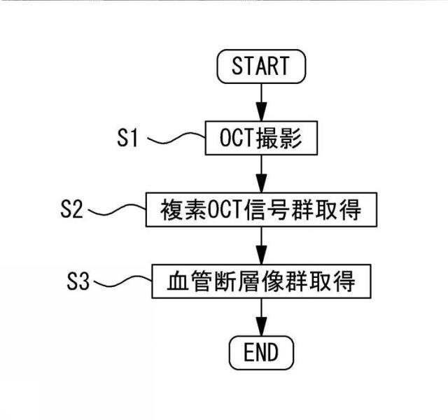 6402921-光コヒーレンストモグラフィ装置、および速度測定用プログラム 図000008