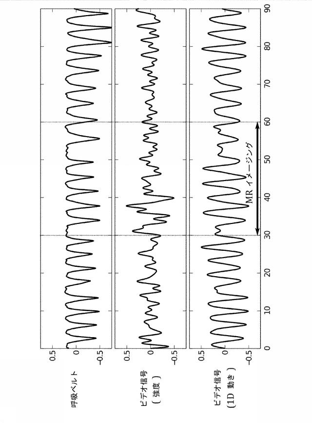6426201-同時磁気共鳴イメージング中の非接触式生理学的モニタリング 図000008