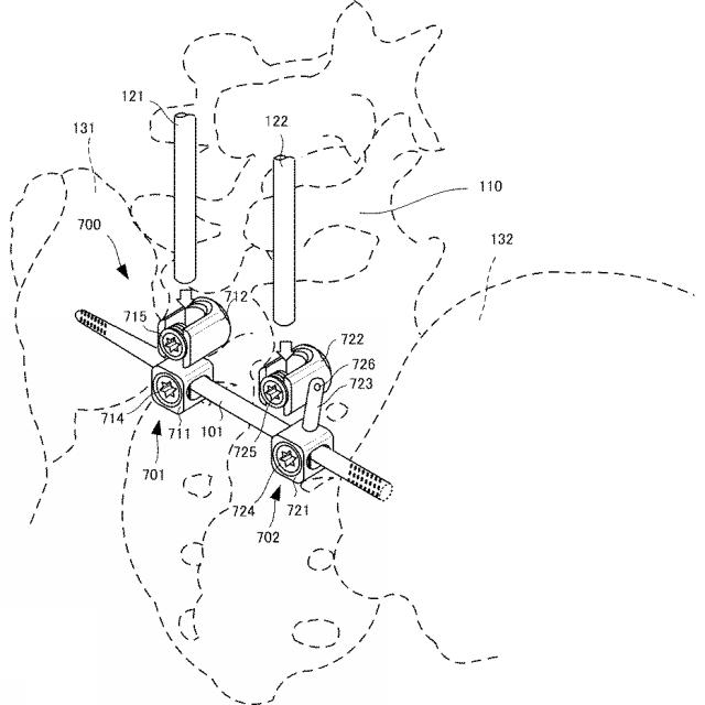 6433017-椎骨固定ロッド連結用インプラント 図000008