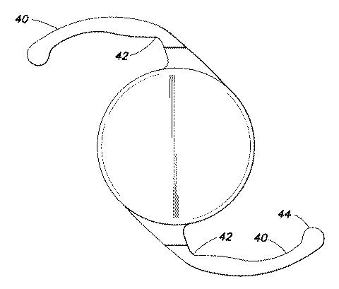 6448030-眼内レンズ 図000008