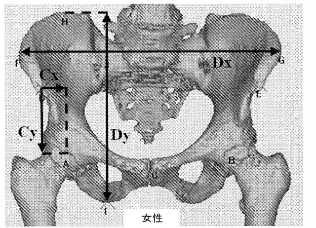 6525582-股関節の面再建 図000008