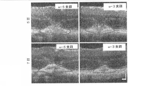 6526570-炎症及び血管形成を減少させるＣＹＰ４５０脂質メタボライト 図000008