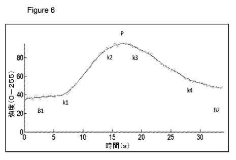 6561180-血管造影及びかん流の定量化並びに解析手法 図000008