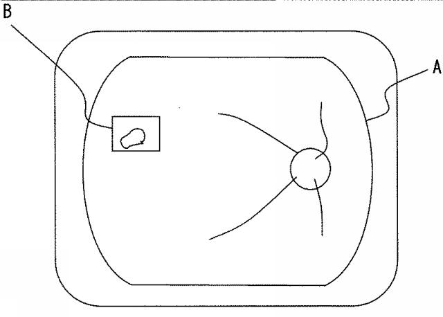 6580998-視野計 図000008