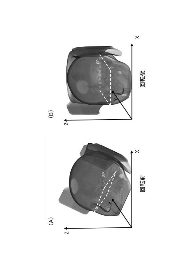 6731870-医用断面表示装置及び断面画像表示方法 図000008