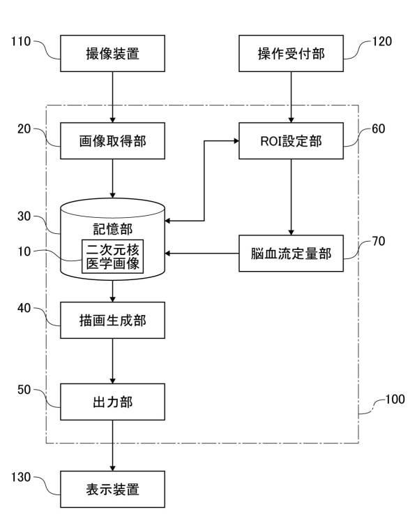 6948217-脳血流量定量方法、脳血流量定量プログラム及び脳血流量定量装置 図000008