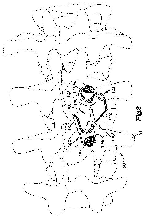 5658237-患者装着式開創器 図000009