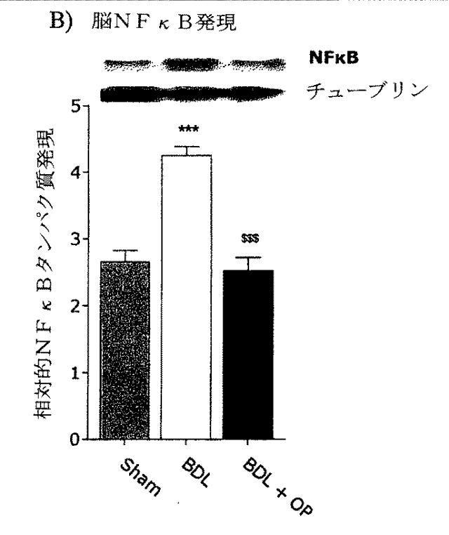 5749255-Ｌ−オルニチンフェニル酢酸塩を用いる門脈圧亢進の治療及び肝機能の修復 図000009