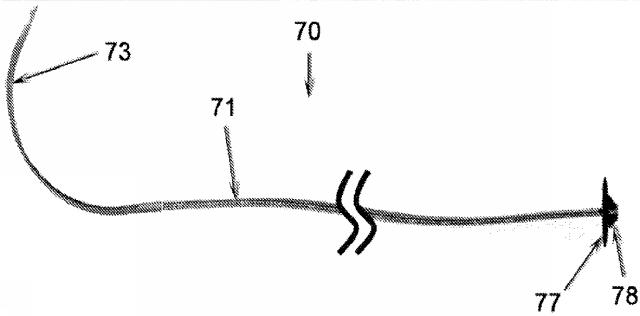 5763535-幹細胞または他の生理活性材料が組み込まれた外科手術用縫合糸 図000009