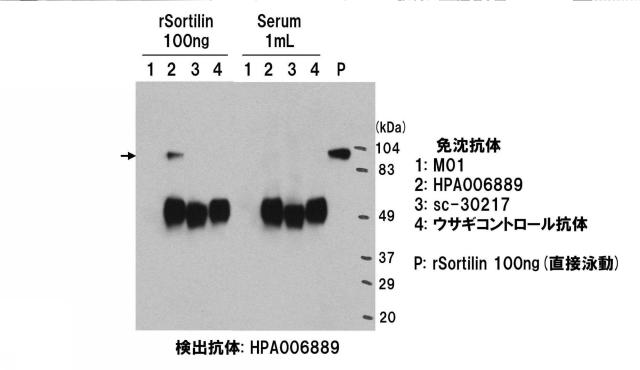 5852433-ソルチリンによる動脈硬化の判定方法 図000009