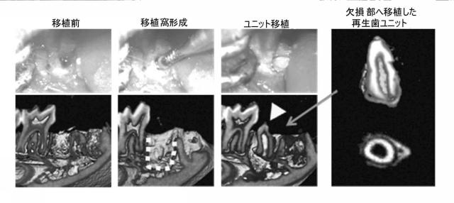 5868844-再生歯ユニットの製造方法 図000009