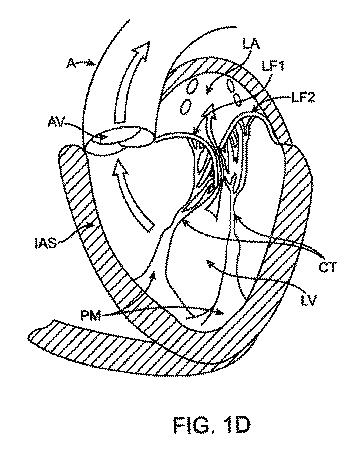 5872692-人工治療装置 図000009