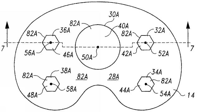 5916989-異なる質感を有する表面を備えた人工関節及びその人工関節の作製方法 図000009