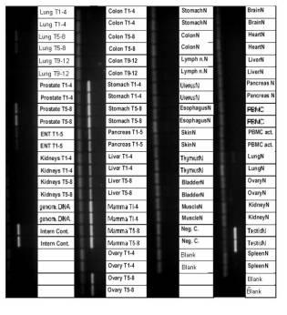 5922159-腫瘍診断と治療のための表面関連抗原の同定 図000009