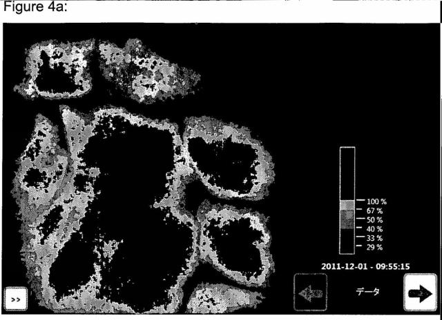 5977440-光コヒーレントイメージング医療デバイス 図000009