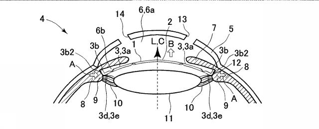 6023378-眼内レンズ及び眼内レンズのハプティック 図000009