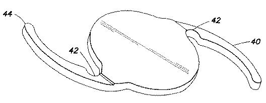 6448030-眼内レンズ 図000009