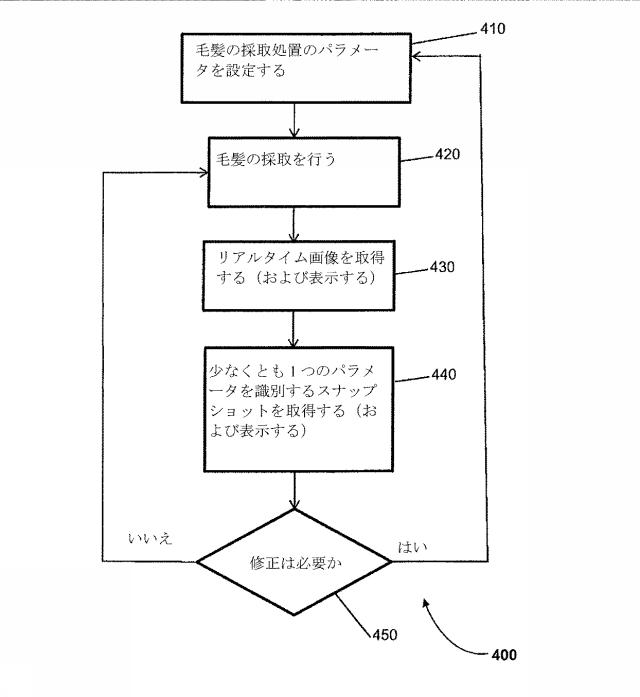 6560371-自動化された処置のパラメータを修正するための方法およびシステム 図000009