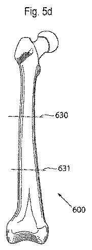 6636420-骨整形用の装置および方法 図000009