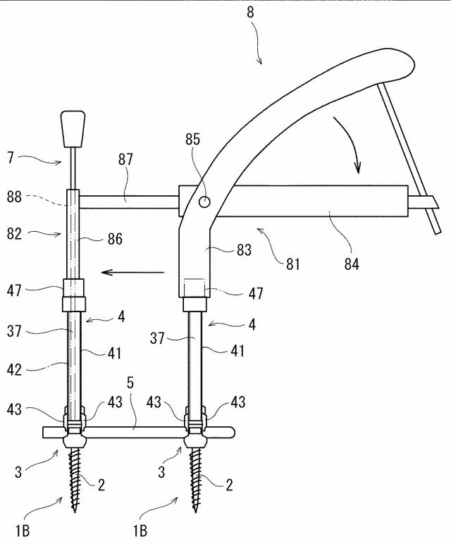 6662891-脊椎固定用保持具およびそれを備えた脊椎固定システム 図000009