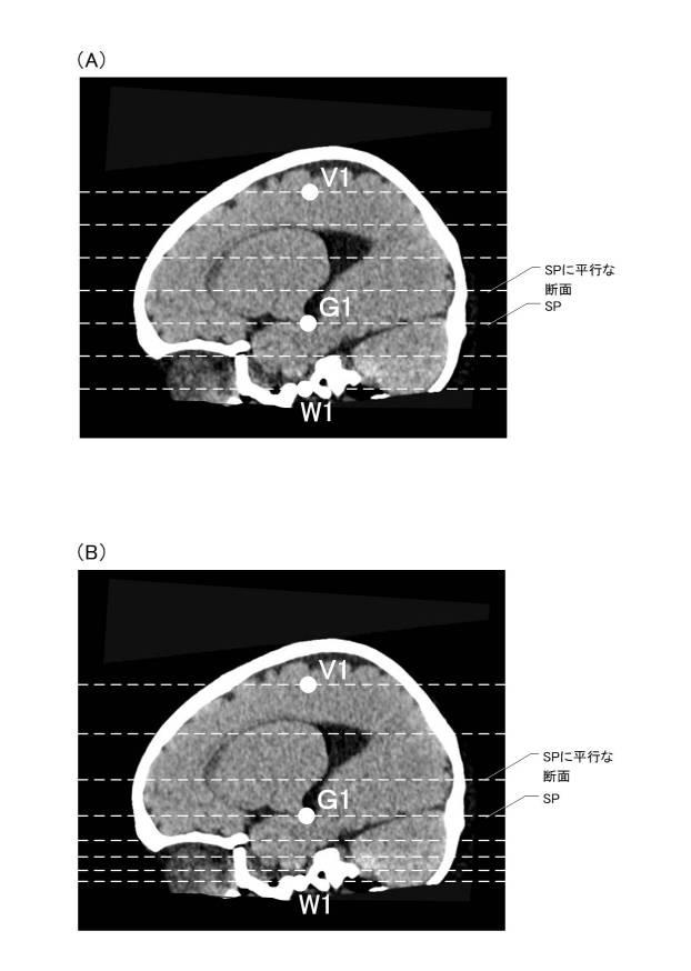 6731870-医用断面表示装置及び断面画像表示方法 図000009