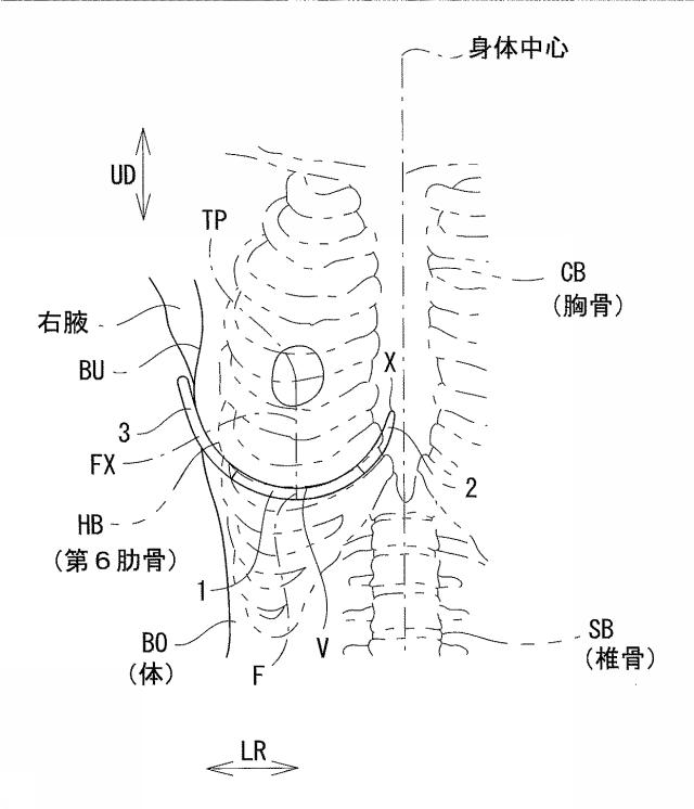 6874237-カップ部用樹脂ワイヤー、及びカップ部付き衣類 図000009