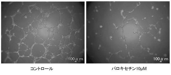 6952980-血管新生阻害薬 図000009