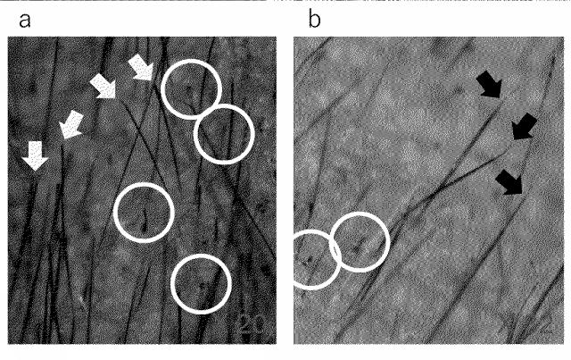 6979582-変異型蛋白質、及び該変異型蛋白質を発現し円形脱毛を発症する遺伝子改変マウス 図000009