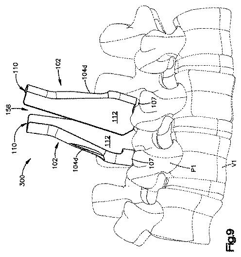 5658237-患者装着式開創器 図000010