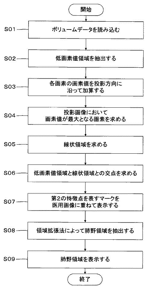 5835881-医用画像処理装置、及び医用画像処理プログラム 図000010