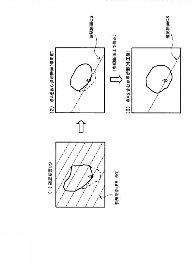 5841771-超音波データ処理装置 図000010