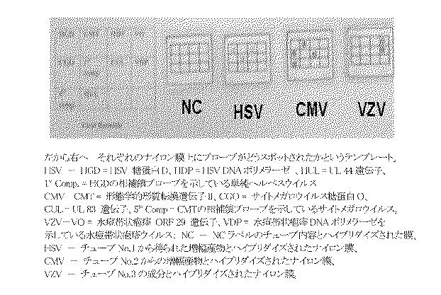 5927243-眼および中枢神経系の細菌、真菌、寄生虫およびウイルス感染の同時検出と識別のための新規な方法 図000010