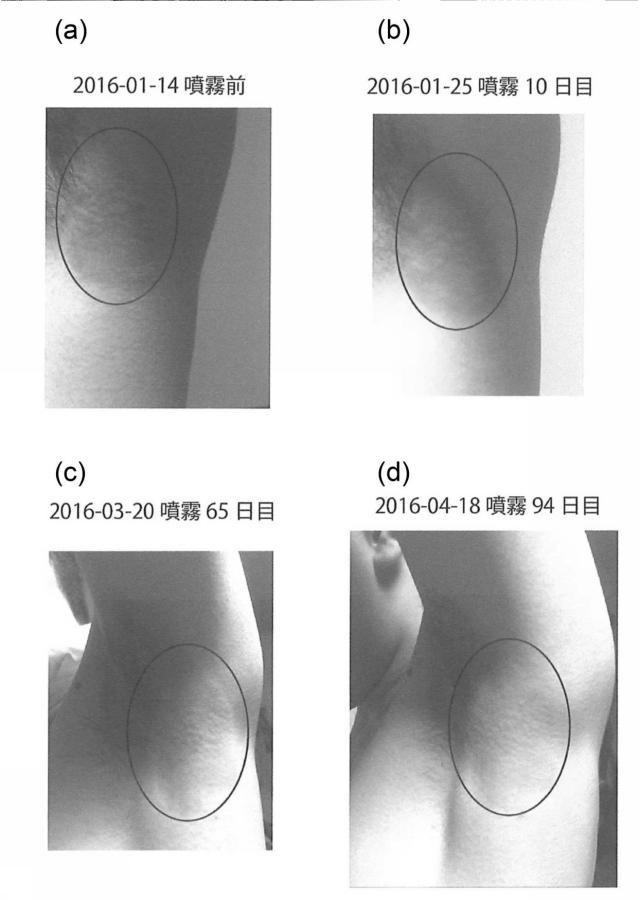 6152205-化粧品、医薬用組成物、およびそれらの製造方法 図000010