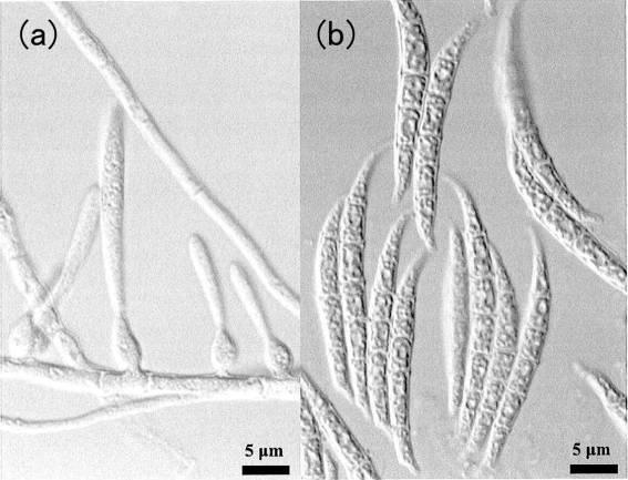 6234721-アスファルテン分解能力を有する新規微生物 図000010