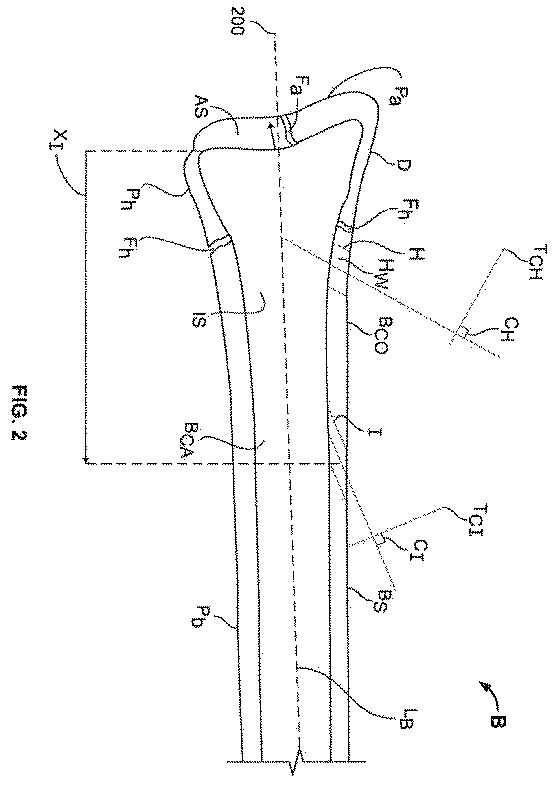 6316876-骨インプラントを固定するための装置および方法 図000010