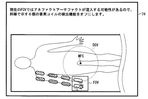 6407620-磁気共鳴イメージング装置 図000010