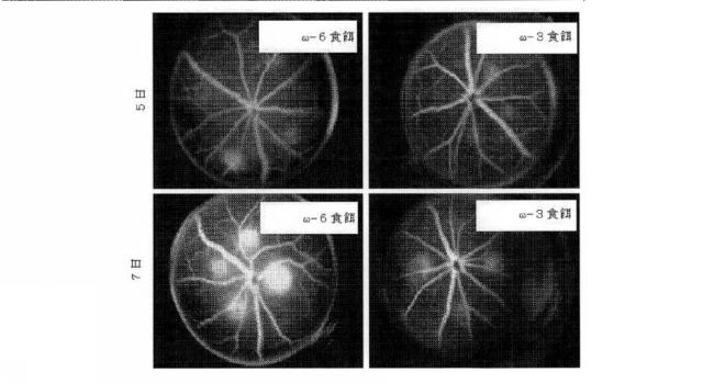 6526570-炎症及び血管形成を減少させるＣＹＰ４５０脂質メタボライト 図000010