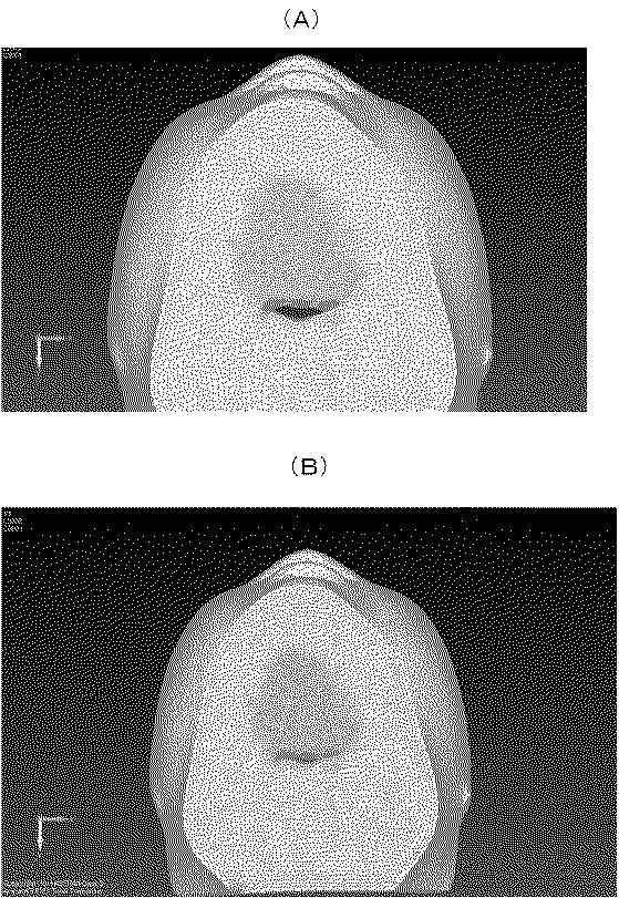 6579472-顎顔面部の流体構造連成解析を用いた気道通気状態解析システム 図000010