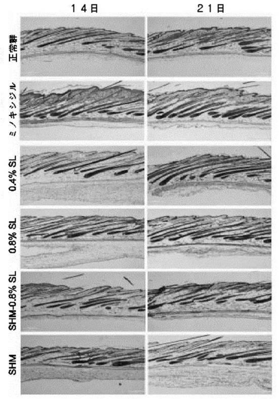 6734250-ソホロリピッドを有効成分として含有する脱毛防止または発毛促進用組成物の製造方法 図000010