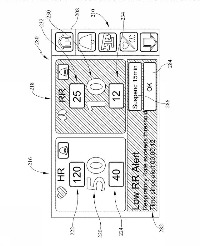 6805121-バイタルサインのモニター機能およびアラート機能を有する患者支持装置 図000010