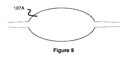 6854282-押圧可能なインプラント送出システム 図000010
