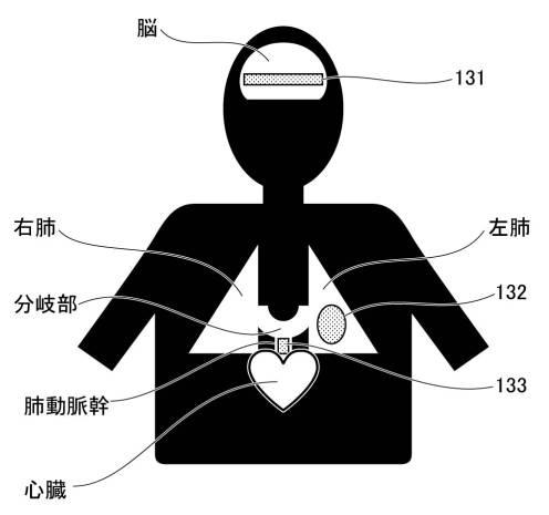 6948217-脳血流量定量方法、脳血流量定量プログラム及び脳血流量定量装置 図000010