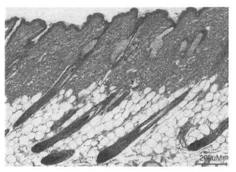 6979582-変異型蛋白質、及び該変異型蛋白質を発現し円形脱毛を発症する遺伝子改変マウス 図000010