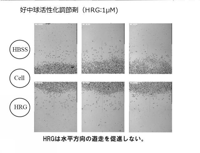 5807937-好中球活性化に起因する疾患の治療薬、治療方法及び検査方法 図000011