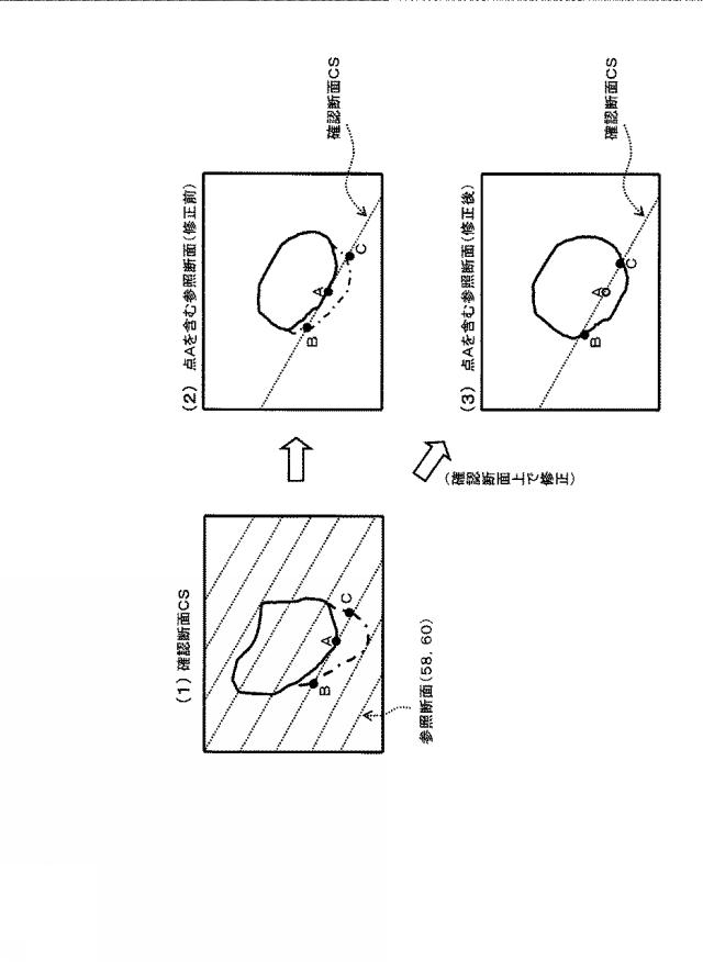 5841771-超音波データ処理装置 図000011