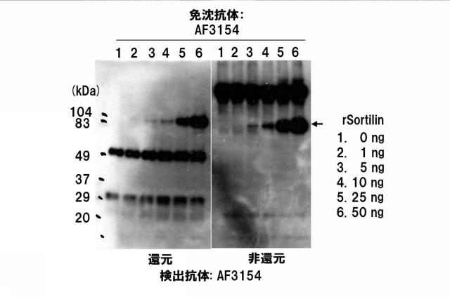 5852433-ソルチリンによる動脈硬化の判定方法 図000011