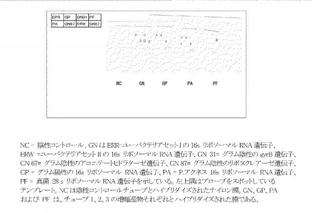 5927243-眼および中枢神経系の細菌、真菌、寄生虫およびウイルス感染の同時検出と識別のための新規な方法 図000011