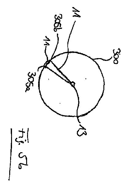 6027540-個々の軸状ファイバーを含む装置、及び医療用インプラントを折り畳み又は展開するための組み合わせ装置 図000011