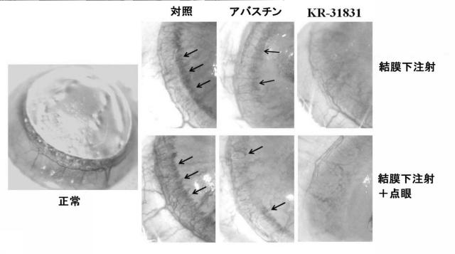 6099209-黄斑変性の予防または治療用の医薬組成物 図000011