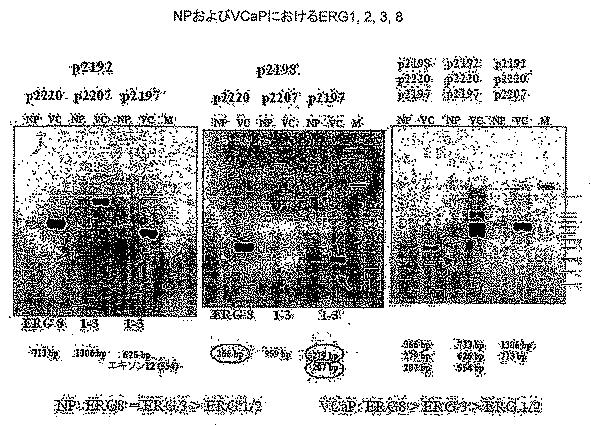 6383743-ＥＲＧ遺伝子発現における前立腺癌特異的変化ならびにそれらの変化に基づく検出および治療方法 図000011